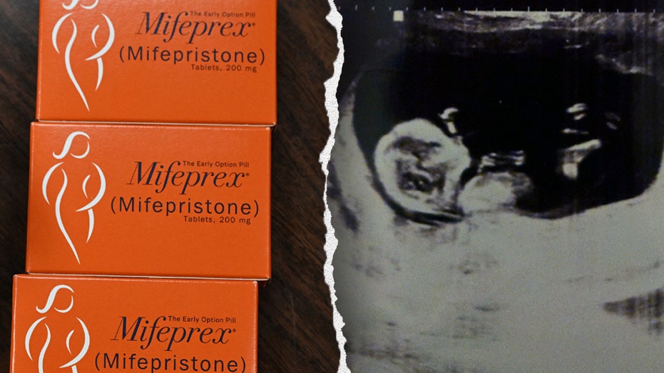 texas-man-sues-california-doctor-in-unprecedented-abortion-pill-case-over-unborn-child’s-alleged-‘murder’