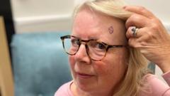 Digital imaging cuts waiting times for skin cancer