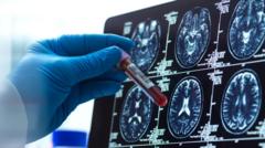 alzheimer’s-blood-test-could-‘revolutionise’-diagnosis