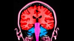 can-a-pulse-of-electricity-to-the-brain-make-us-less-selfish?